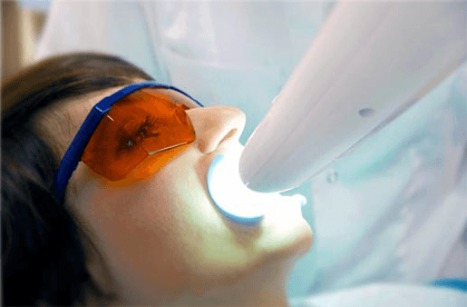 Understanding the Causes of Teeth Sensitivity Nottingham