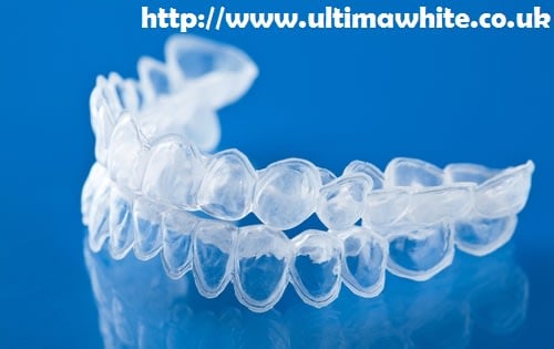 Bleaching Trays vs At-Home Laser Teeth Whitening Nottingham