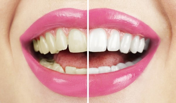 What Early Signs of Oral Cancer Should You Never Ignore Nottingham?