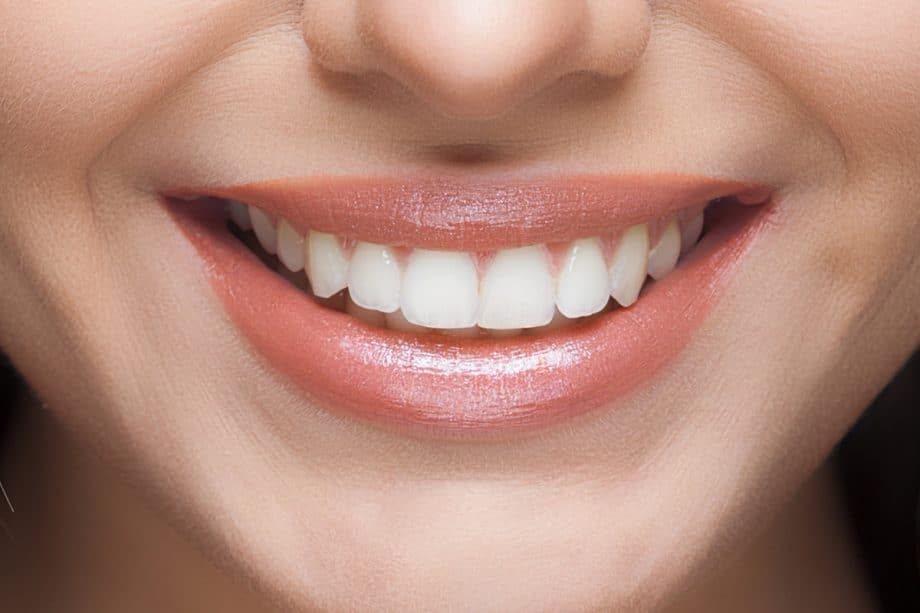 Smart Daily Habits to Protect Your Enamel Nottingham