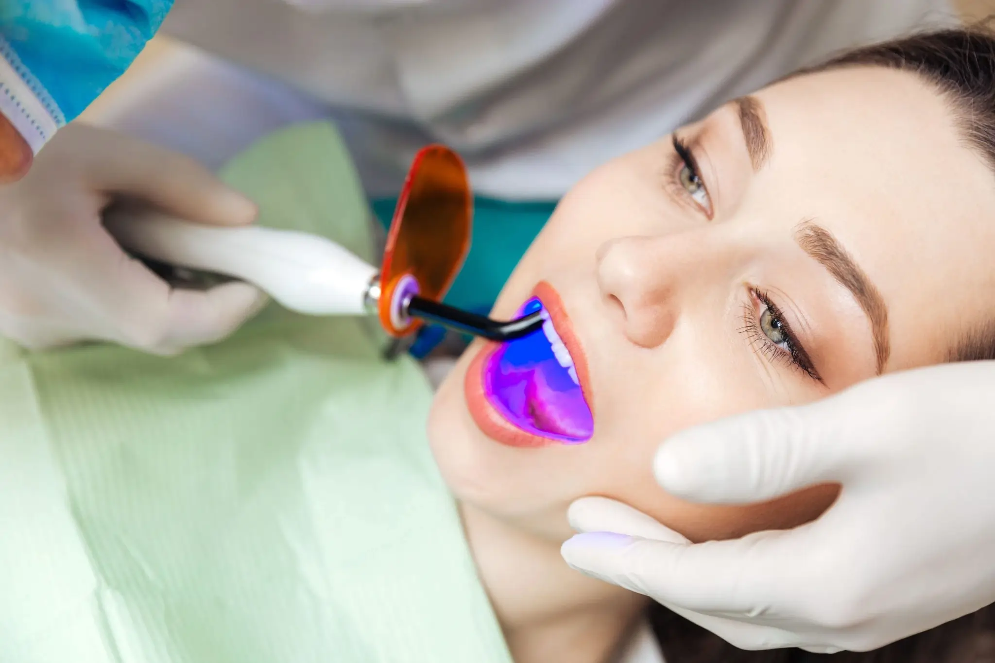 Common Risks of Whitening Without Expert Dental Guidance Nottingham