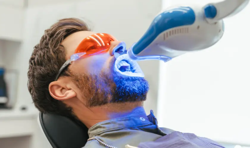 The Hidden Differences Between DIY and Professional Teeth Whitening Nottingham