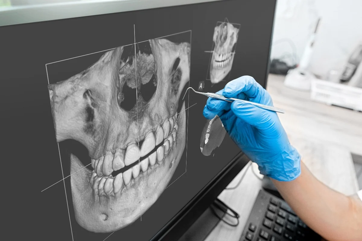 How Is AI Transforming Dental Treatment Planning Nottingham?