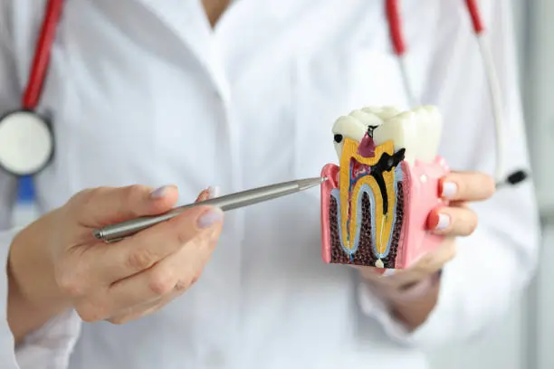 Which Whitening Methods Are Gentler on Sensitive Teeth Nottingham?