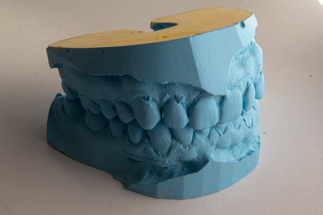 How Do Dental Implants Improve Jawbone Health and Oral Function Nottingham?