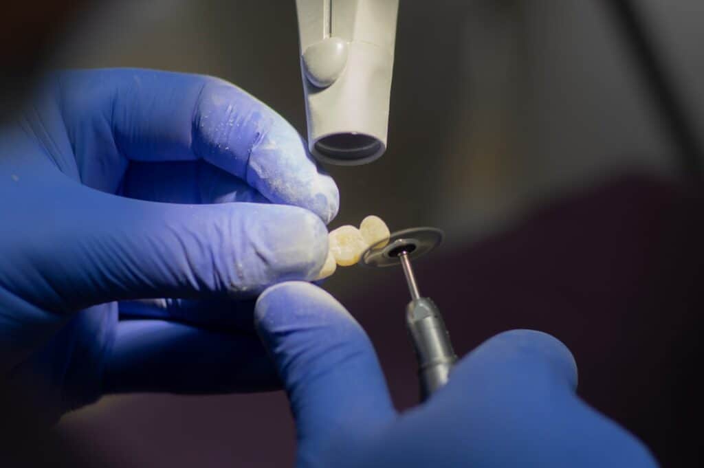 Customised Dental Solutions: Crowns, Aligners, and Implants Nottingham