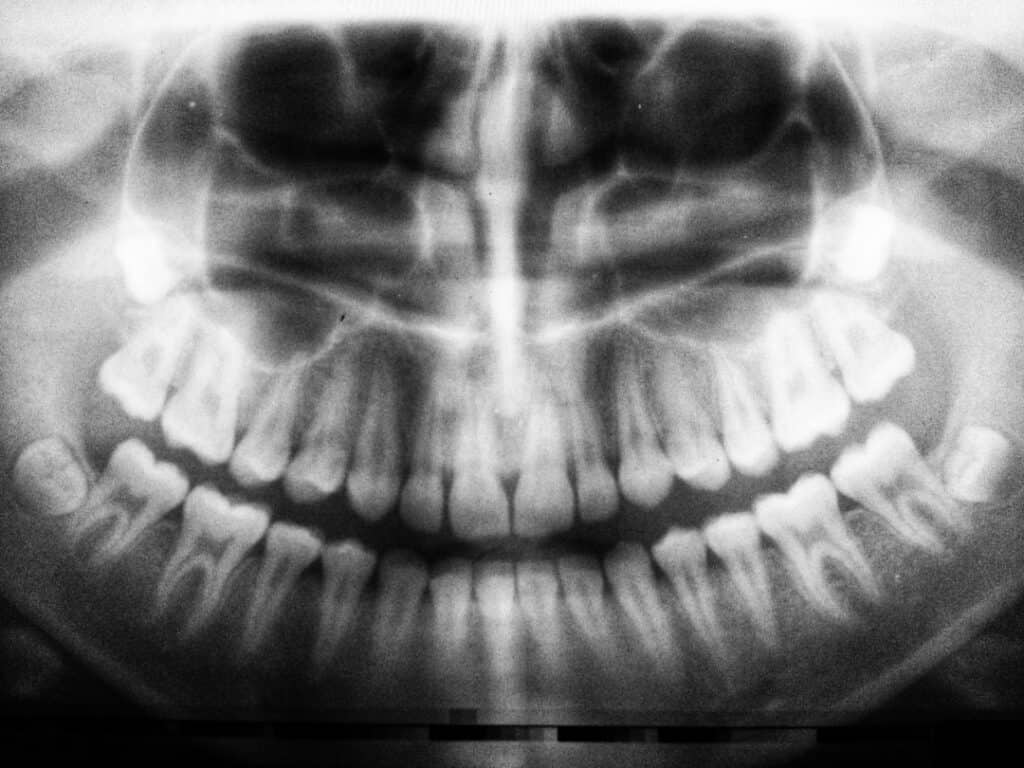 The Future of 3D Printing in Oral Healthcare Nottingham